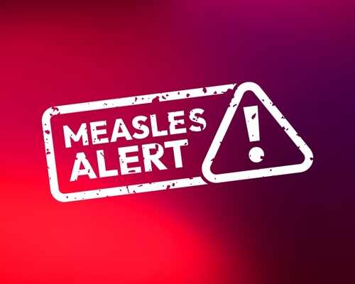 Measles alert warning sign with exclamation mark