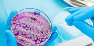 Scientist using a sterile tool to manipulate bacterial culture in a petri dish