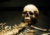 A human skull and skeletal remains displayed in a museum
