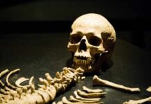 Garage Floor Grave Yields a Name A human skull and skeletal remains displayed in a museum