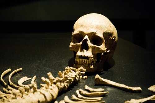 Aachen,,Germany,-,May,17,,2015:,Skull,,Spine,,Ribs,,And A human skull and skeletal remains displayed in a museum