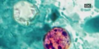 Health Alert: 2 dead, 18K cases reported in cyclosporiasis outbreak