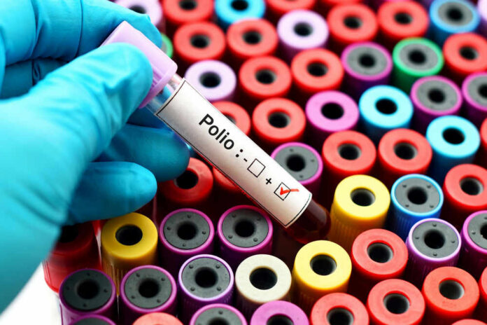 shutterstock_522106639 Gloved hand holding positive polio blood test tube